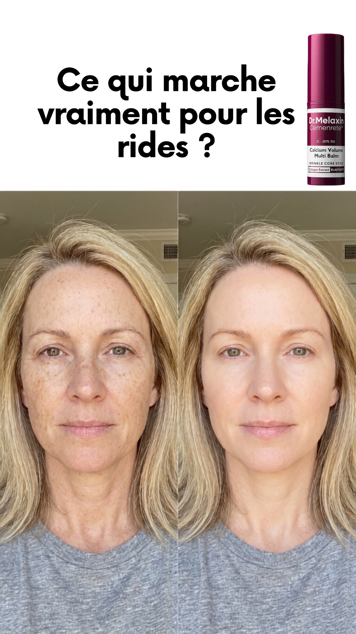 Pourquoi choisir Dr.Melaxin Multi Balm ?
